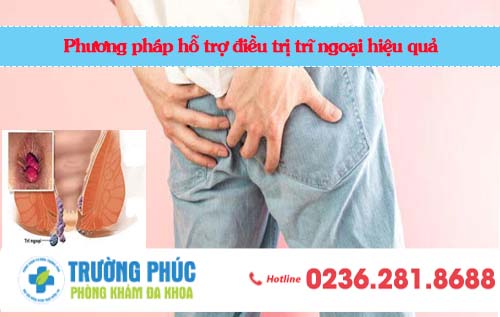 Phương pháp hỗ trợ điều trị trĩ ngoại hiệu quả
