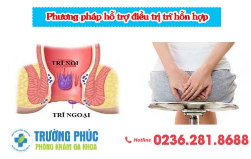 Phương pháp hỗ trợ điều trị trĩ hỗn hợp
