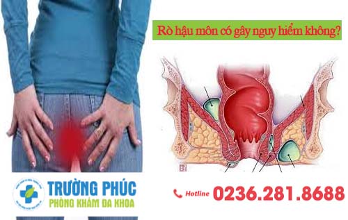 Rò hậu môn có gây nguy hiểm không?