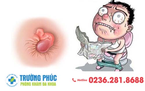 Thịt lòi hậu môn là dấu hiệu của bệnh gì?