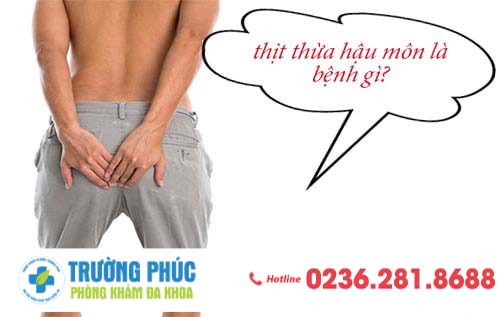 Da thừa ở hậu môn có phải biểu hiện của bệnh trĩ không?