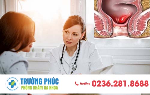 Triệu chứng trĩ nội qua từng cấp độ sẽ khác nhau như thế nào?