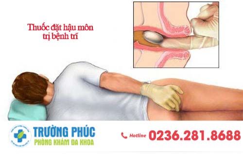Thuốc đặt hậu môn trị bệnh trĩ 