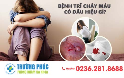 Cẩn thận với bệnh trĩ chảy máu: Tác hại và cách khắc phục an toàn