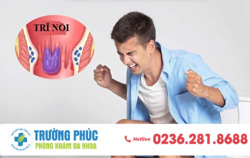 Dấu hiệu nhận biết bệnh trĩ nội là gì?