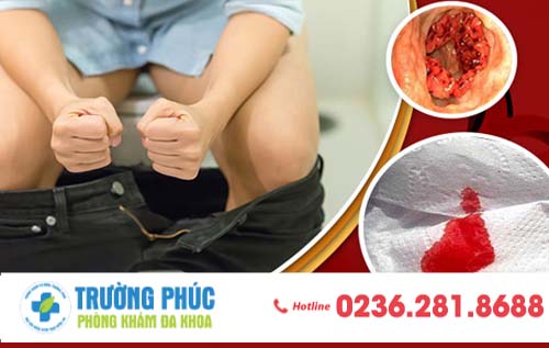 Đi vệ sinh ra máu là dấu hiệu bệnh gì? Có nguy hiểm như thế nào?