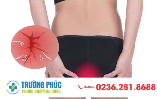 Tổng hợp những điều cần biết về viêm hậu môn